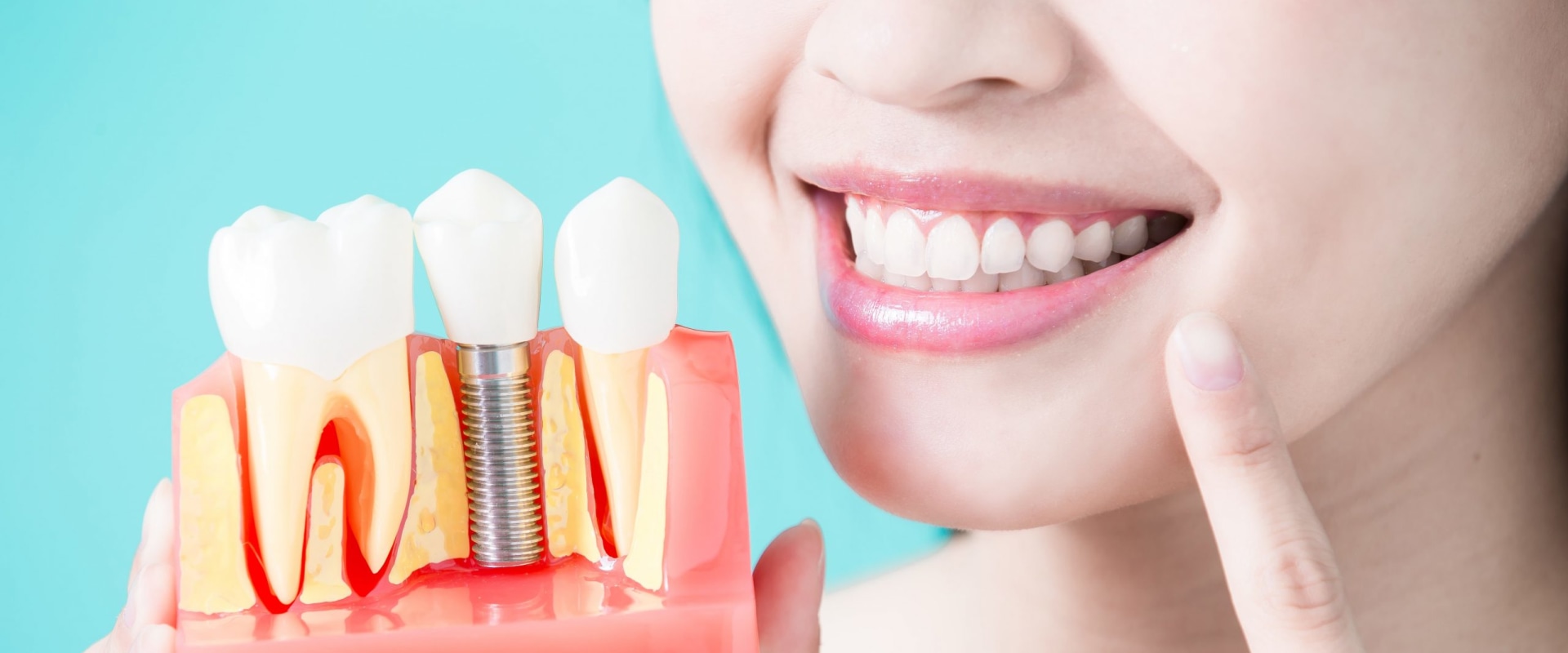 Restoring Confidence: The Importance Of Dental Implants For A Complete Smile In Ashburn