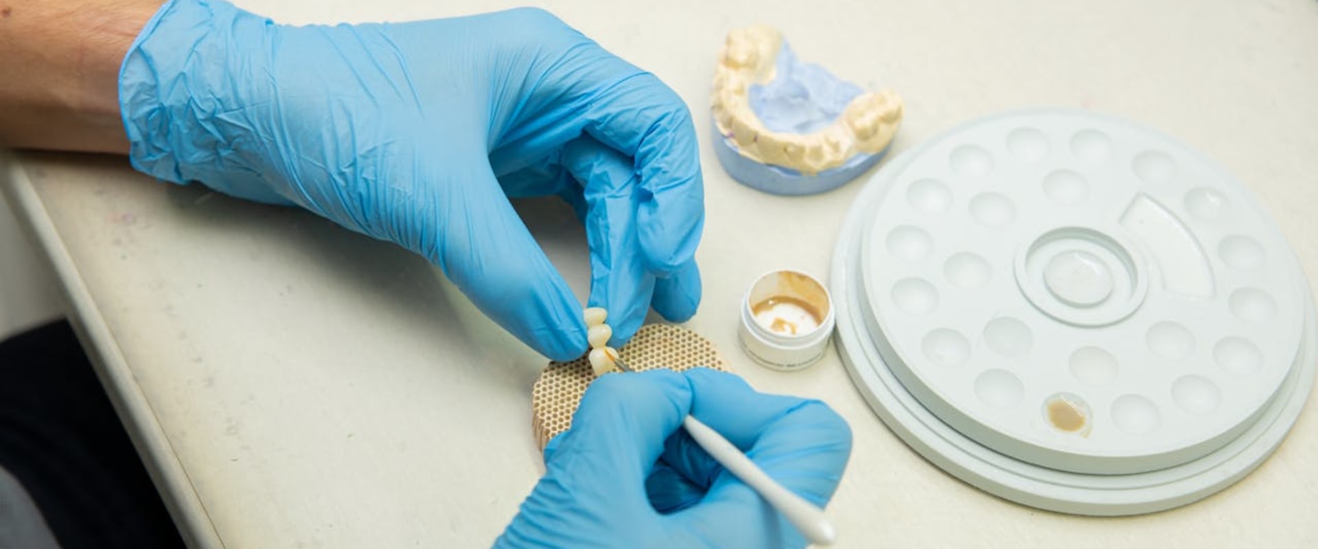 The Permanent Solution: Understanding Dental Implants In Saginaw, MI