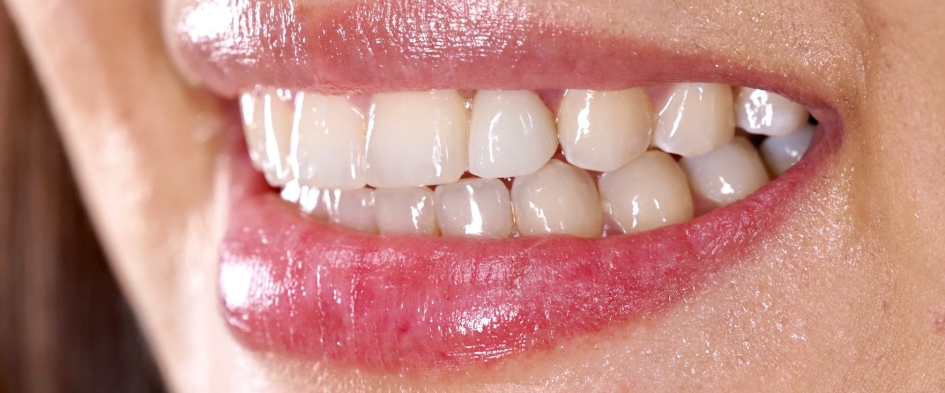 Transform Your Smile with Dental Implants and Orthodontics