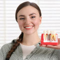 Transforming Smiles: Dental Implants In Stockton