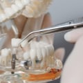 Will dental implants get cheaper?