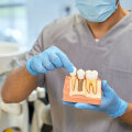 Understanding Dental Implants In Austin, TX: The Latest Advances In Dental Technology