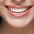 Get The Perfect Smile With Professional Dental Implants Care From Clifton Park's Top Family Dentists