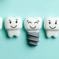 Discovering The Benefits Of Dental Implants In Austin