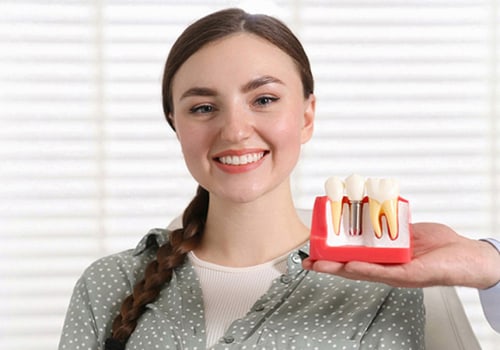 Transforming Smiles: Dental Implants In Stockton