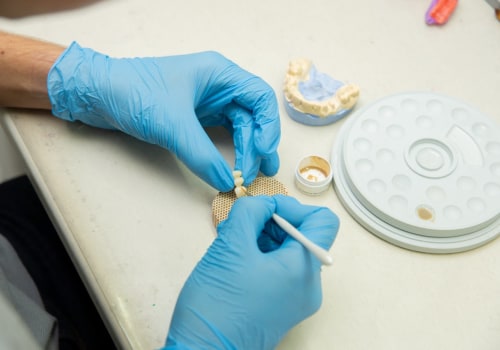 The Permanent Solution: Understanding Dental Implants In Saginaw, MI