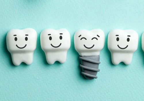 Discovering The Benefits Of Dental Implants In Austin